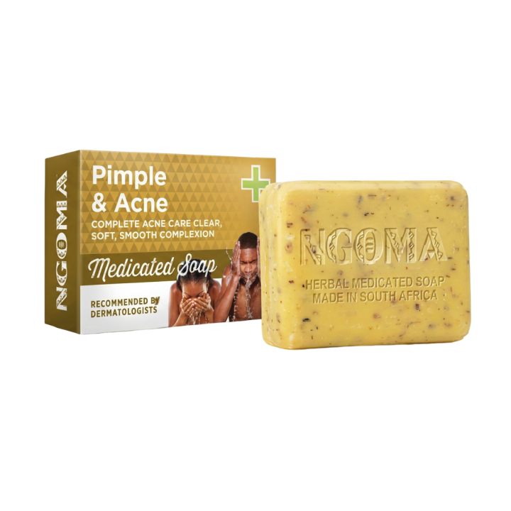 NGOMA Pimple & Acne Medicated Soap 110 g | Proudly SA